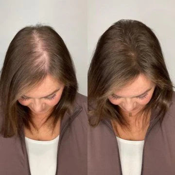 RevitaRoot™ Organic Rosemary Hair Growth Shampoo