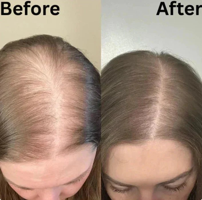RevitaRoot™ Organic Rosemary Hair Growth Shampoo